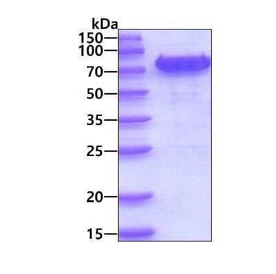 SDS-PAGE: Recombinant Mouse IL-3R alpha/CD123 hIgG-His Protein [NBP3-18359]